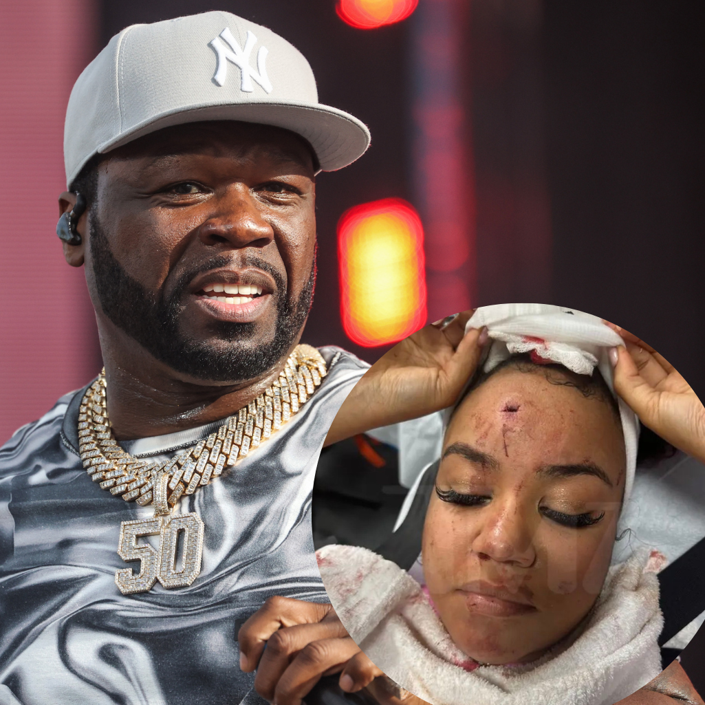 50 Cent: Η γυναίκα που τραυμάτισε σε συναυλία του από το μικρόφωνο που της πέταξε, κατέθεσε μήνυση εις βάρος του 