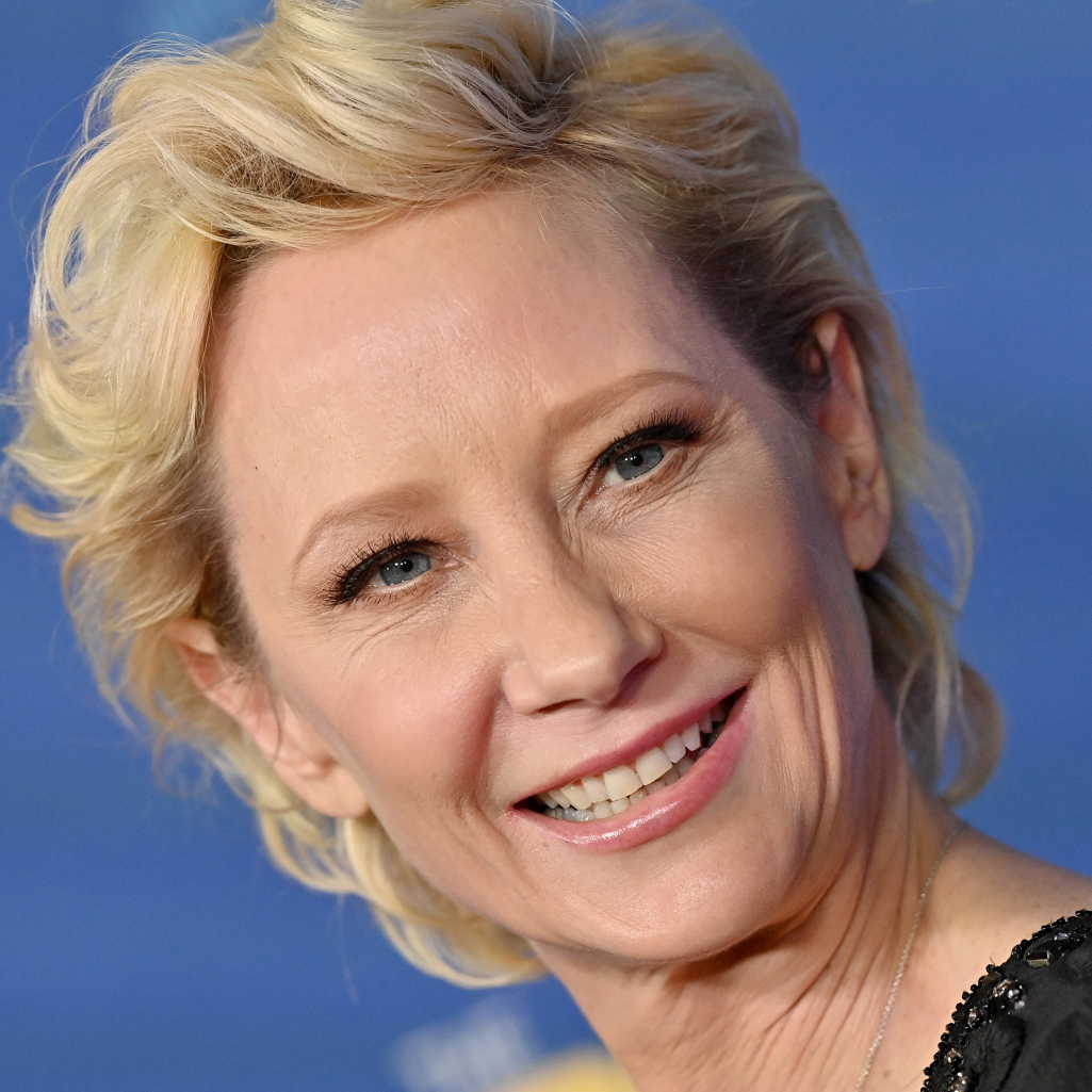 Anne Heche: Πέθανε η ηθοποιός μία εβδομάδα μετά το μοιραίο τροχαίο