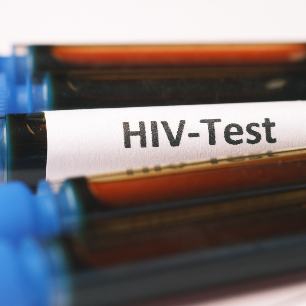 Η Johnson & Johnson λέει πως το μόνο εμβόλιο κατά του HIV σε κλινικές δοκιμές απέτυχε