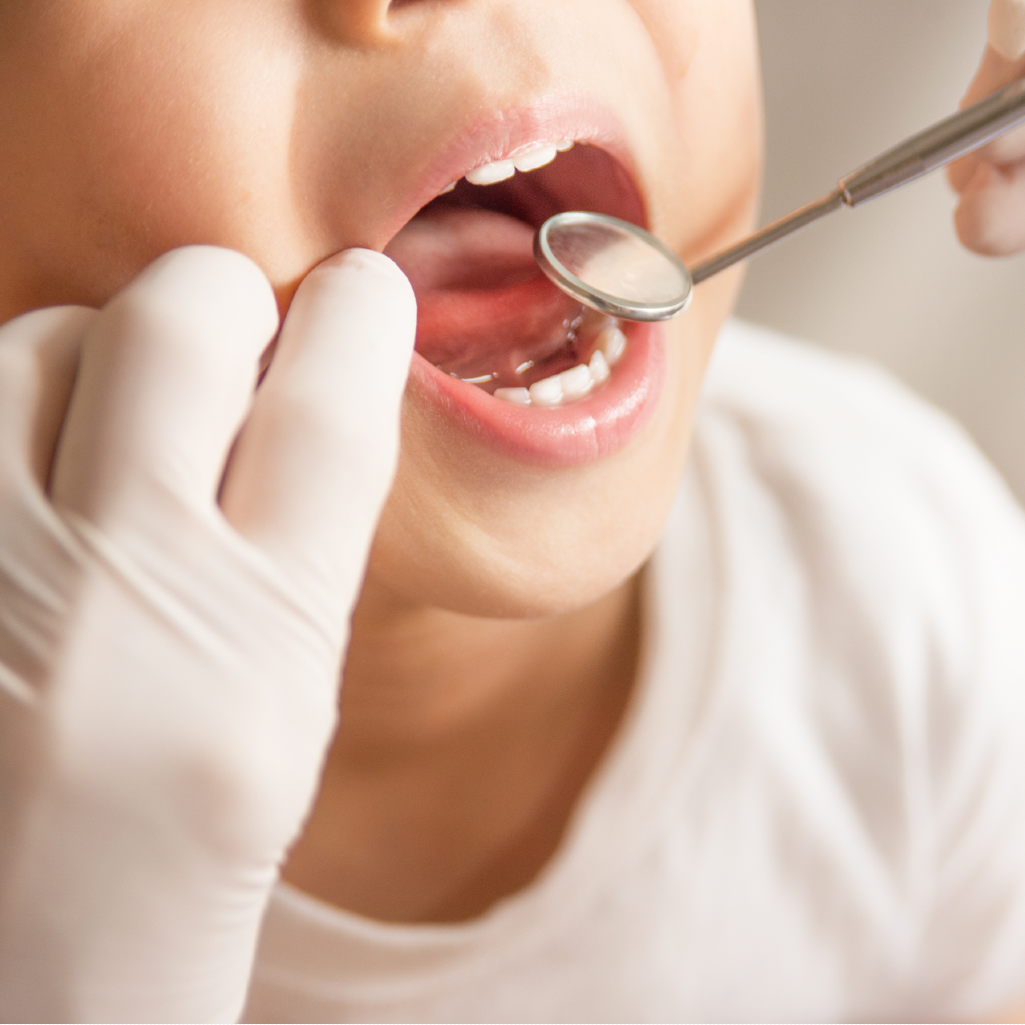 Dentist Pass! Προληπτική οδοντιατρική φροντίδα για πολλά υγιή παιδικά χαμόγελα!