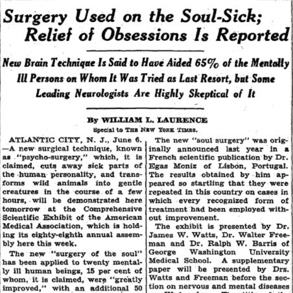 Εσένα, θα σου έκαναν λοβοτομή; Άρθρο των NY Times από το '37 έχει τα συμπτώματα
