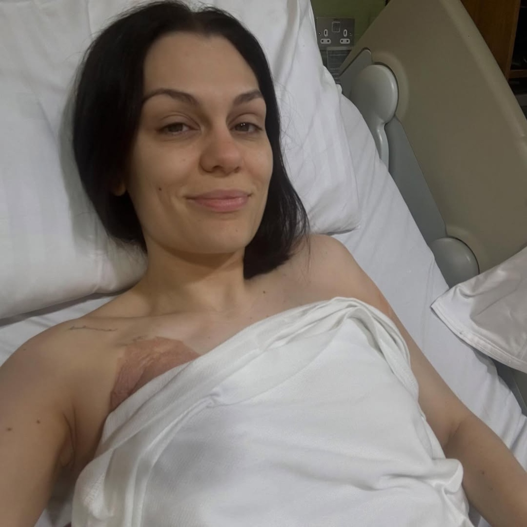 Η Jessie J χειρουργήθηκε, μετά τη διάγνωση με καρκίνο - Οι "σκληρές" και οι όμορφες εικόνες μέσα από το νοσοκομείο