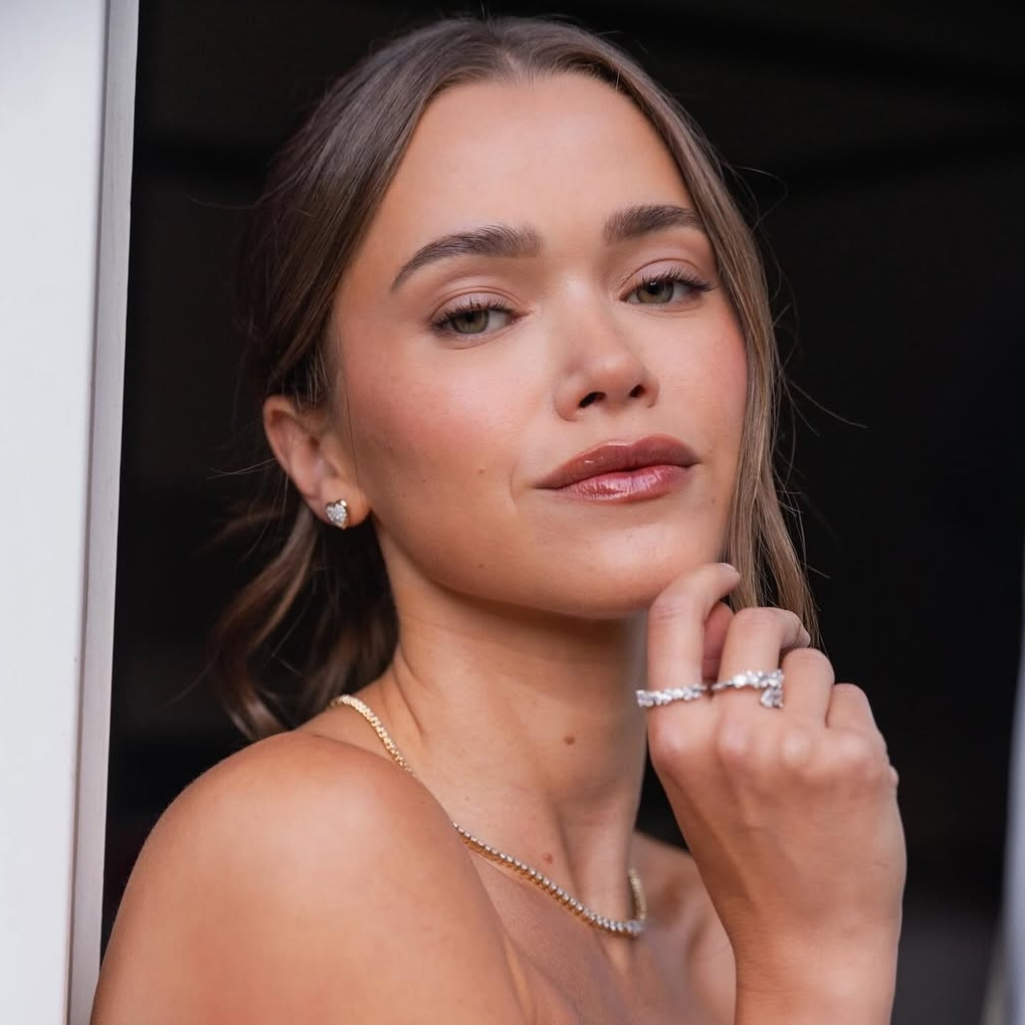 ακμή στο πηγούνι