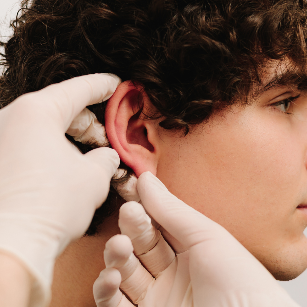 Αναίμακτη ωτοπλαστική χωρίς νυστέρι: Η νέα τεχνική που διορθώνει τα “πεταχτά αυτιά” μόνο με τοπική αναισθησία