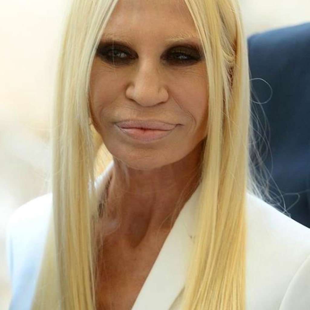 Donatella-Versace-plastic-surgery-921καθετα.jpg
