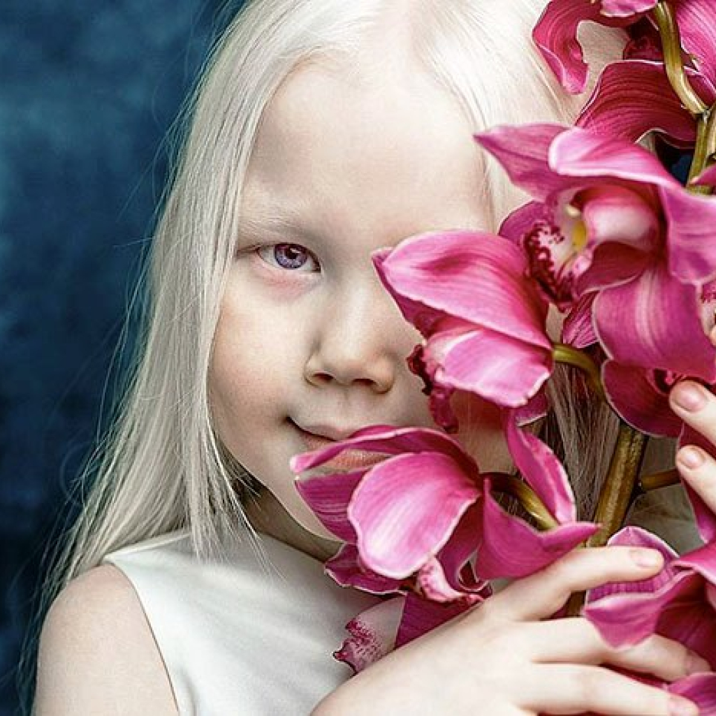 albino-girl-snow-white-nariyana-siberia-7.jpg
