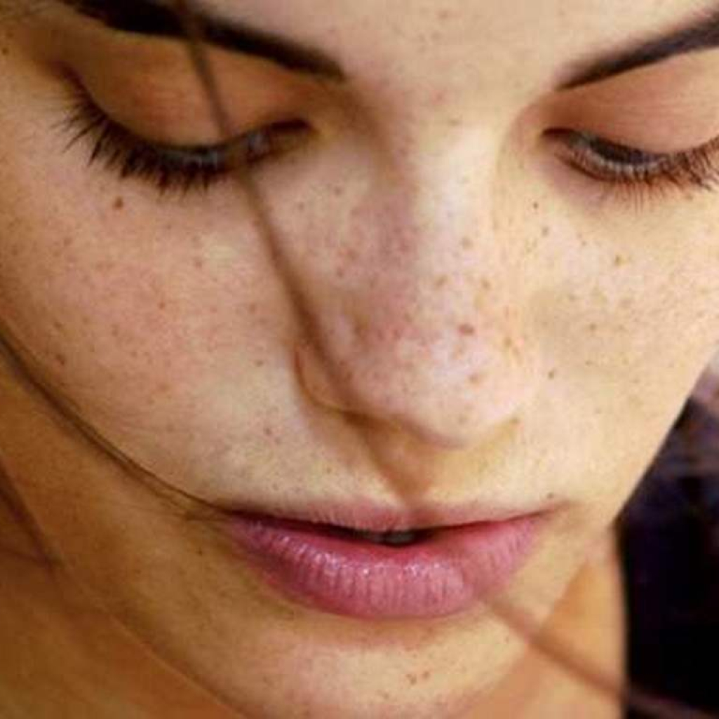 3-natural-methods-to-rid-yourself-of-brown-spots-on-your-schedule.jpg