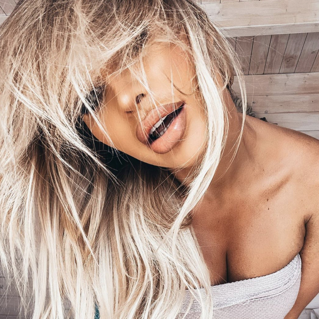Η Rosanna Arkle φέρνει επιτέλους το καλοκαίρι