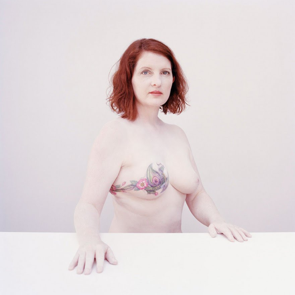 Η νίκη απέναντι στον καρκίνο του μαστού: Η ομορφιά των τατουάζ σε γυναίκες με μαστεκτομή