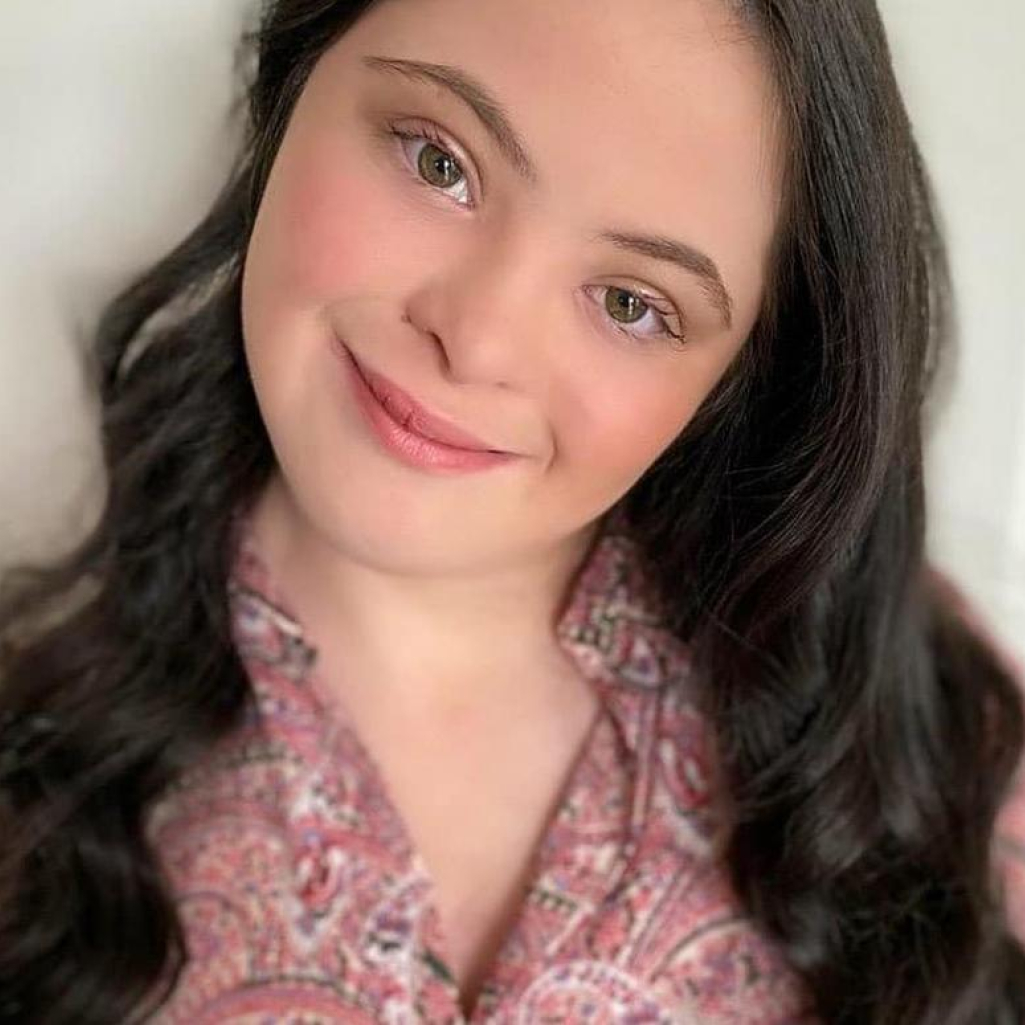 Ellie Goldstein: Το 18χρονο μοντέλο με σύνδρομο Down πρωταγωνιστεί σε εξώφυλλο, καταρρίπτοντας τα στερεότυπα για τα Άτομα με Αναπηρία 