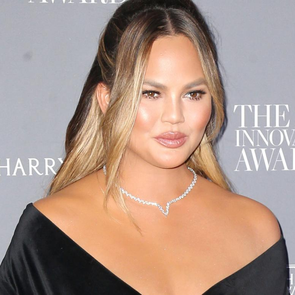 Η Chrissy Teigen μόλις έκανε την πιο τολμηρή αλλαγή στα μαλλιά της που δύσκολα θα δοκίμαζε άλλη star