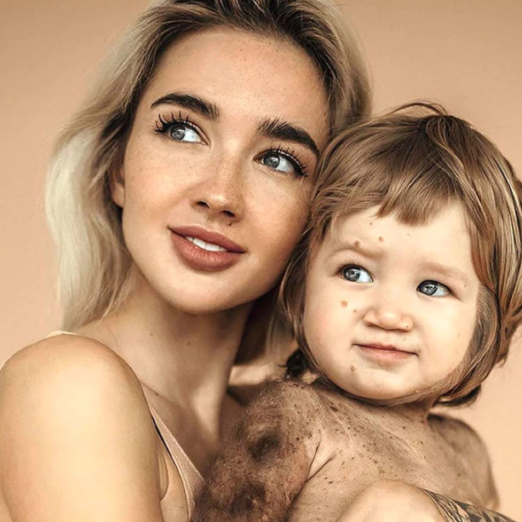 Ekaterina Mezenova: Η Ρωσίδα influencer που ευαισθητοποιεί τον κόσμο για την σπάνια ασθένεια του γιου της και ο αγώνας της να τον σώσει