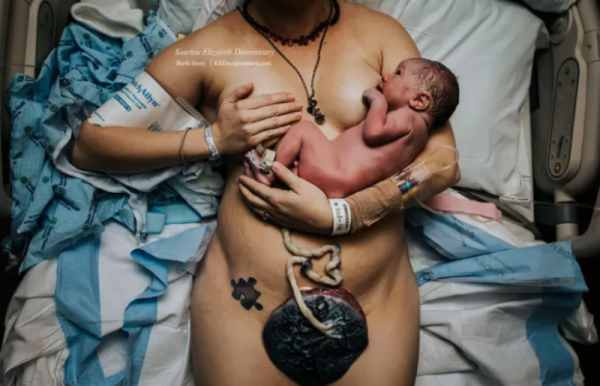Μία μητέρα με το μωρό της και τον πλακούντα της.
Kourtnie Scholz – KEDocumentary / Via kedocumentary.com