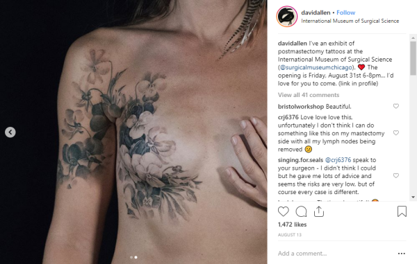 6 τατουάζ που μετατρέπουν τις μαστεκτομές σε έργα τέχνης