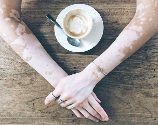 Όταν ο καφές μοιάζει με το δέρμα σου
