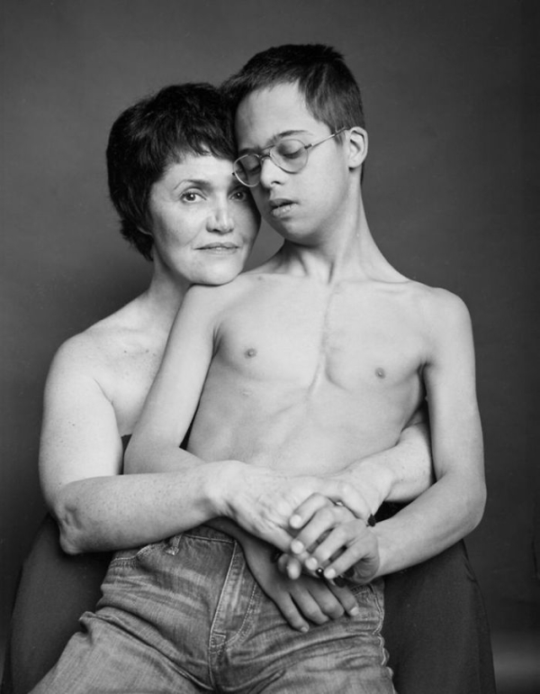 Η μητέρα Tanya Με τον 15χρονο γιο της, Lev με σύνδρομο Down/ Photo Credits: Roman Pashkovskiy
