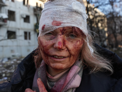 Olena Kurylo: Η Ουκρανή που έγινε το σύμβολο του πολέμου, σήμερα ζει ως πρόσφυγας στην Πολωνία 