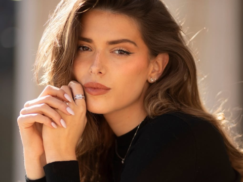 ρυτίδες έκφρασης