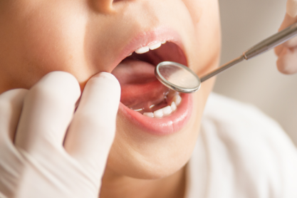 Dentist Pass! Προληπτική οδοντιατρική φροντίδα για πολλά υγιή παιδικά χαμόγελα!