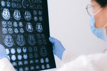 Αλτσχάιμερ: Επιστήμονες ανακάλυψαν πιθανό τρόπο επιδιόρθωσης της μνήμης στους ασθενείς 