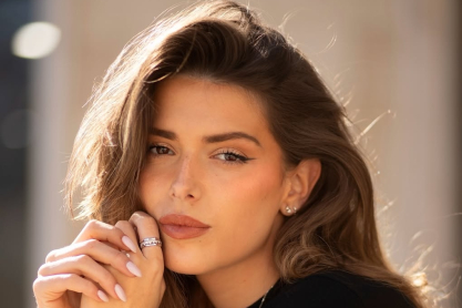 ρυτίδες έκφρασης