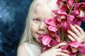 albino-girl-snow-white-nariyana-siberia-7.jpg