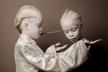 albino-twins-models-1-58e74afbccf94-880.jpg