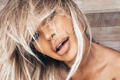 Η Rosanna Arkle φέρνει επιτέλους το καλοκαίρι