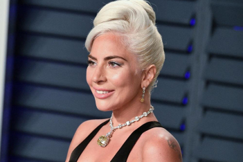 Το σπάνιο post της Lady Gaga χωρίς ίχνος μακιγιάζ, που έκανε τους fans να την αγαπήσουν περισσότερο