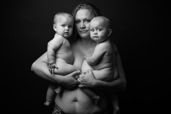 Αγκαλιά με τα παιδιά της, μία γυναίκα δείχνει το υπέροχο σώμα της πριν και μετά τη μαστεκτομή 