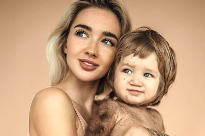 Ekaterina Mezenova: Η Ρωσίδα influencer που ευαισθητοποιεί τον κόσμο για την σπάνια ασθένεια του γιου της και ο αγώνας της να τον σώσει