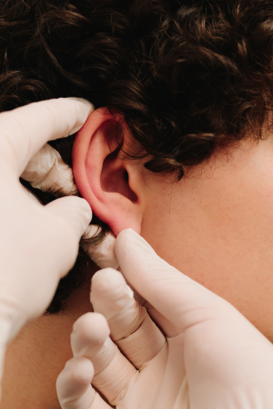 Αναίμακτη ωτοπλαστική χωρίς νυστέρι: Η νέα τεχνική που διορθώνει τα “πεταχτά αυτιά” μόνο με τοπική αναισθησία