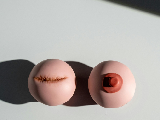 karkinos mastou kai texni